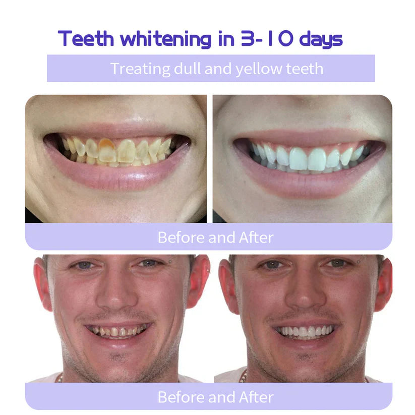 💋 Strengthen Enamel, Whiten Naturally – Your New Go-To Tooth Powder